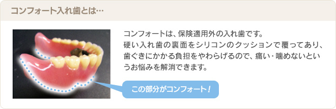 コンフォート入れ歯とは…